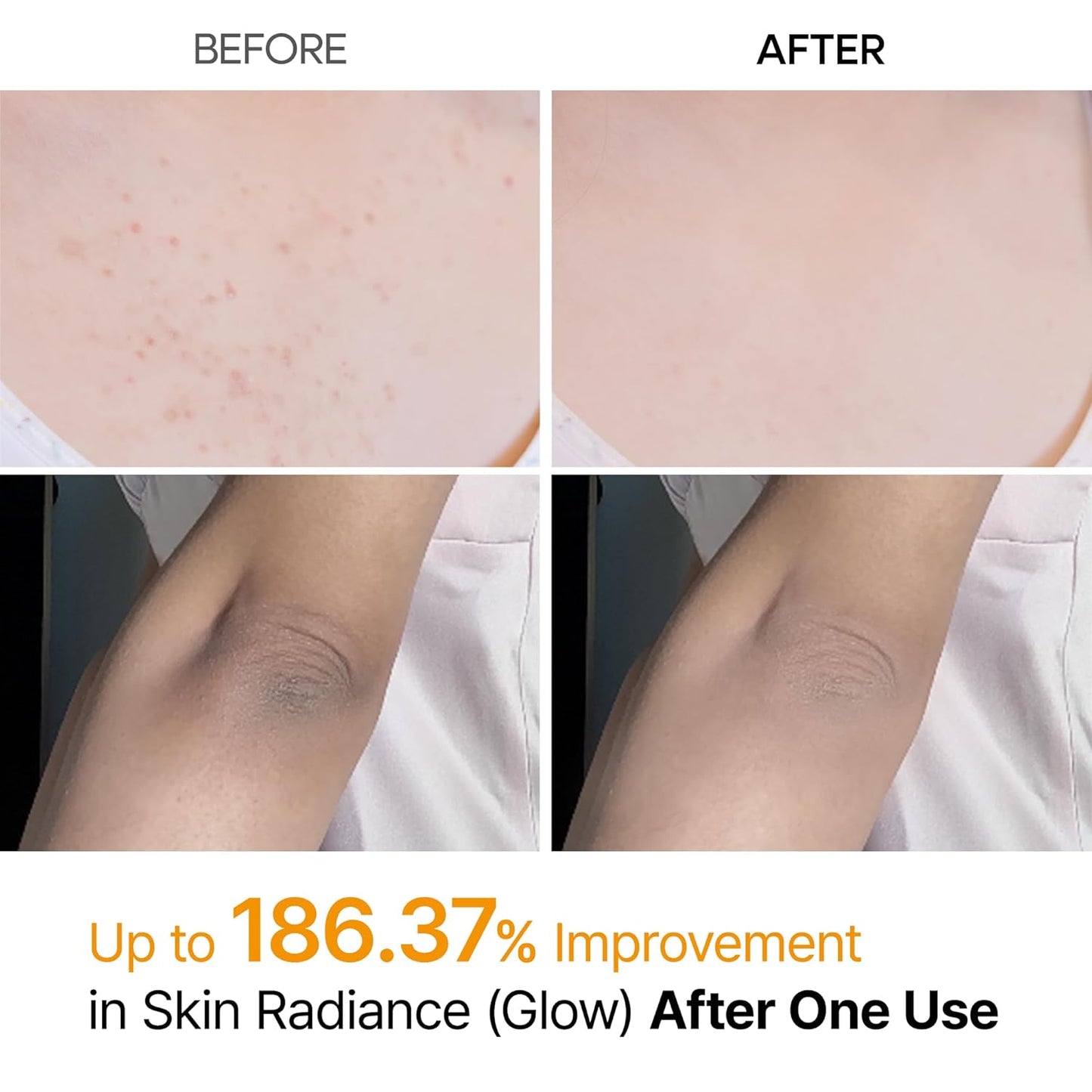 Goodbye "Strawberry Skin," Hello Radiance.